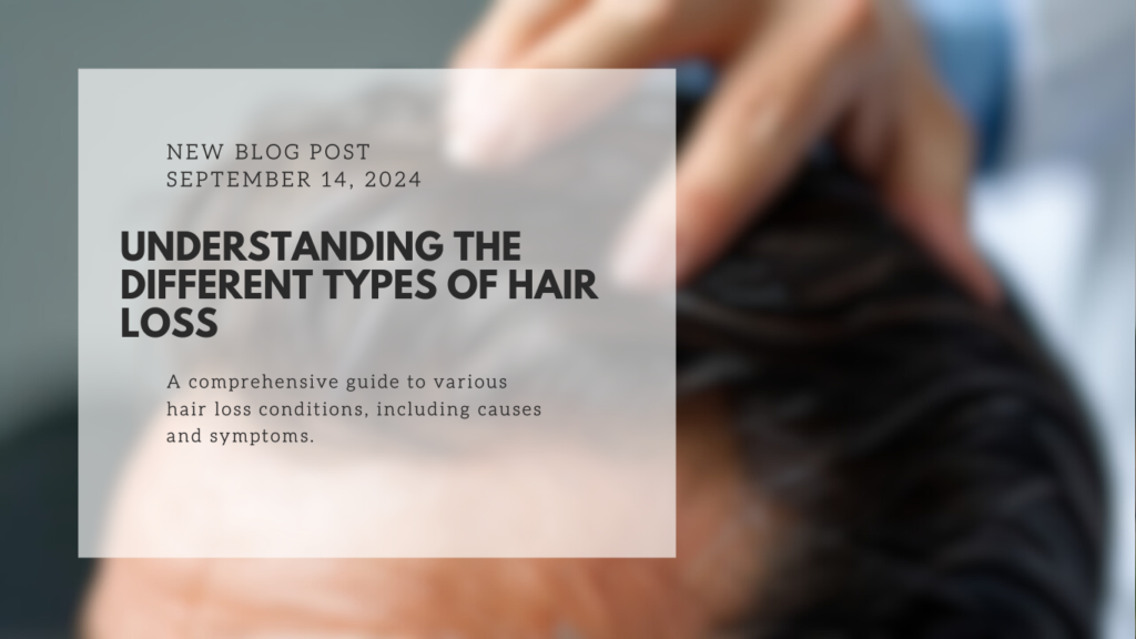 Understanding the Different Types of Hair Loss